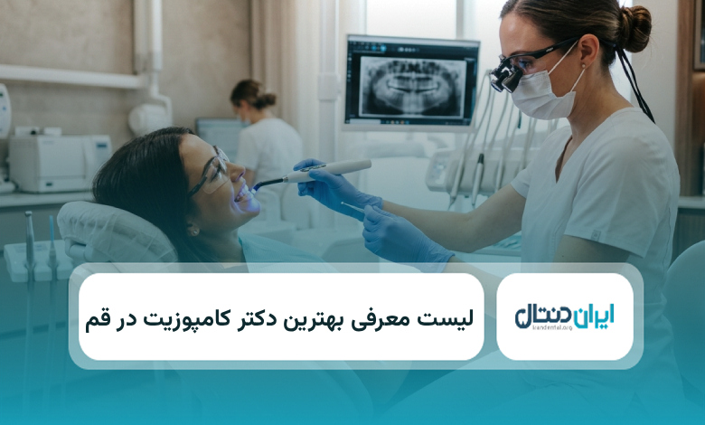 بهترین دکتر کامپوزیت در قم