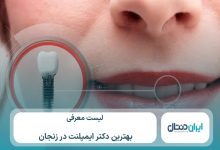 معرفی 10 تا از بهترین دکتر ایمپلنت در زنجان ⚡【سال1405】💙