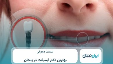 معرفی 10 تا از بهترین دکتر ایمپلنت در زنجان ⚡【سال1405】💙