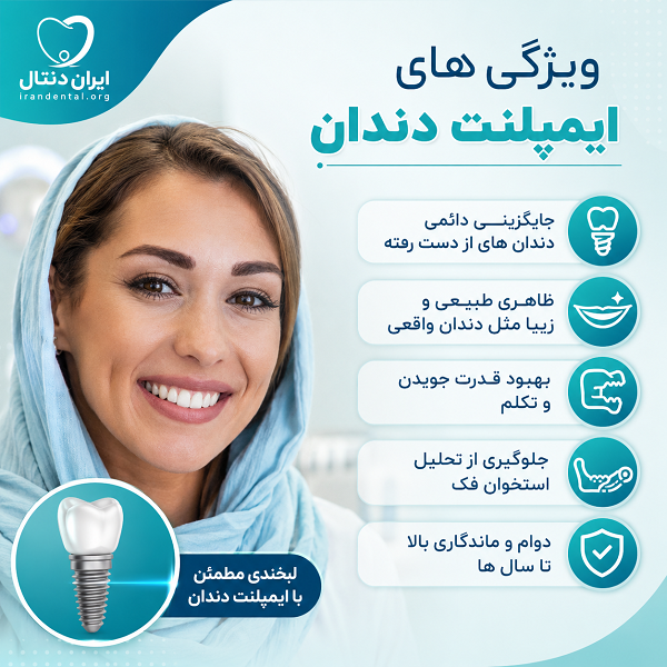 ویزگی های ایمپلنت دندان در زنجان
