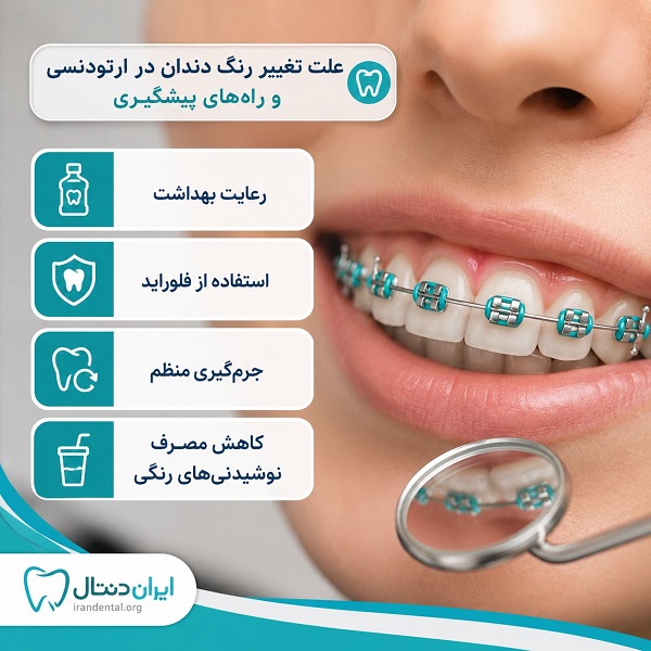 علت تغییر رنگ دندان در ارتودنسی و راه های پیشگیری