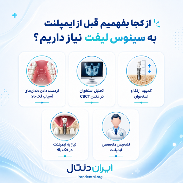 سینوس لیفت چیست و چرا قبل از ایمپلنت انجام میشود؟