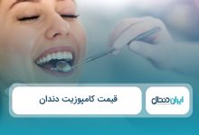 قیمت کامپوزیت دندان
