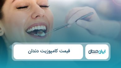 قیمت کامپوزیت دندان