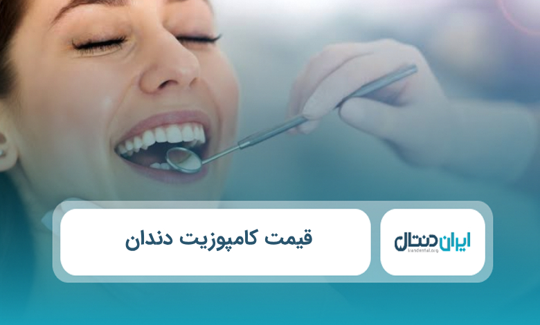 قیمت کامپوزیت دندان
