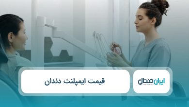 قیمت ایمپلنت دندان