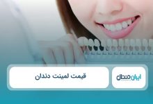 قیمت لمینت دندان