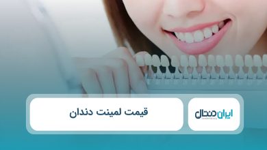 قیمت لمینت دندان