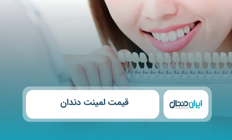 قیمت لمینت دندان