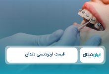 قیمت ارتودنسی دندان