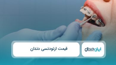 قیمت ارتودنسی دندان