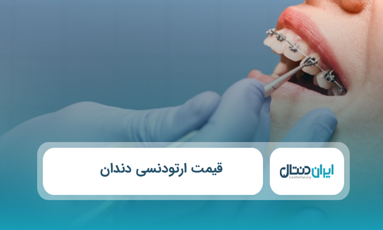 قیمت ارتودنسی دندان