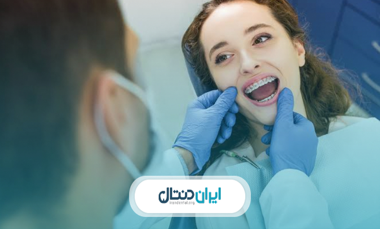 ارتودنسی یک فک ارزانتر است یا دو فک؟