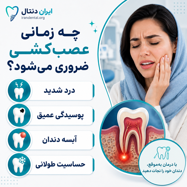 چه زمانی عصب کشی لازم است