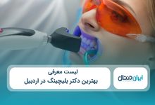 بهترین دکتر بلیچینگ در اردبیل