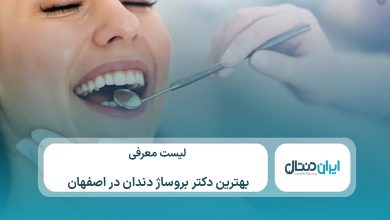 معرفی 10 تا از بهترین دکتر بروساژ دندان در اصفهان⚡【سال1405】💙