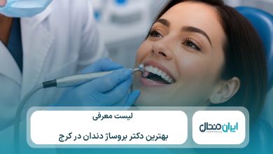 معرفی 10 تا از بهترین دکتر بروساژ دندان در کرج⚡【سال1405】💙