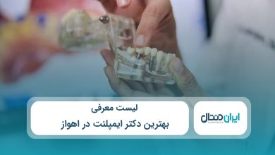 بهترین دکتر ایمپلنت در اهواز