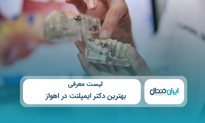 بهترین دکتر ایمپلنت در اهواز