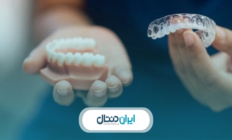 مراقبت از ارتودنسی نامرئی