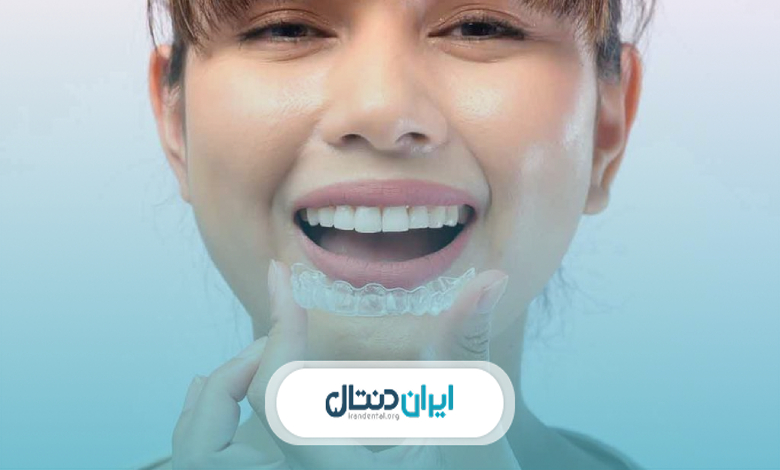 مراقبتهای بعد از ارتودنسی نامرئی