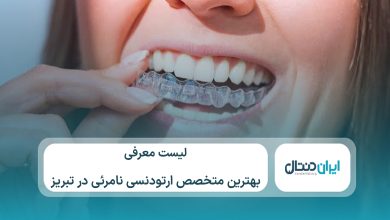 معرفی 10 تا از بهترین متخصص ارتودنسی نامرئی در تبریز⚡【سال1405】💙