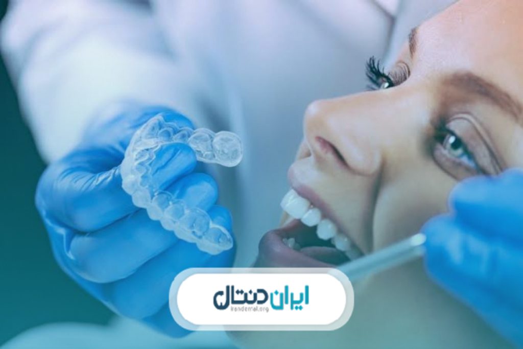 ارتودنسی نامرئی چه مزایایی دارد؟