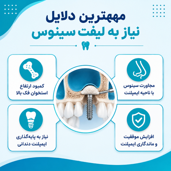 مهمترین دلایل نیاز به لیفت سینوس