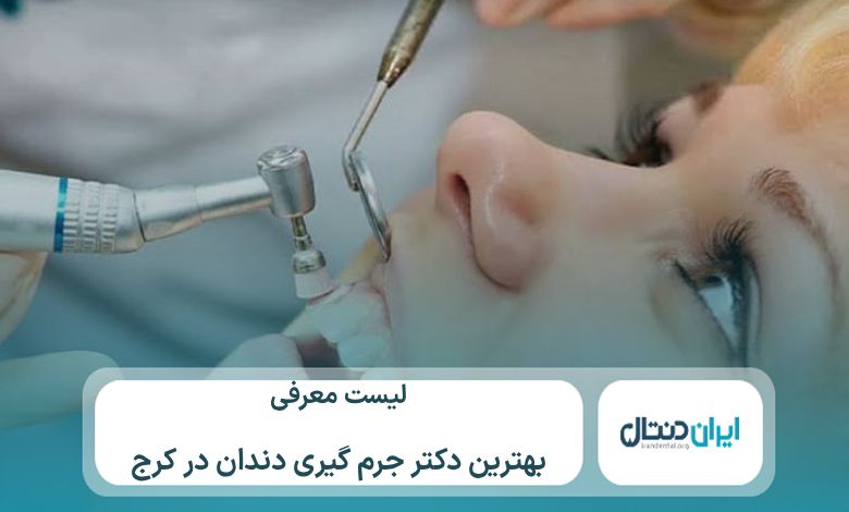 معرفی 10 تا از بهترین دکتر جرم گیری دندان در کرج⚡【سال1405】💙