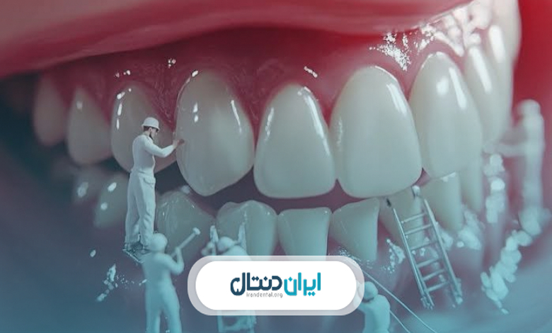 آیا جرمگیری مکرر به دندان آسیب میزند؟