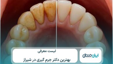 معرفی 10 تا از بهترین دکتر جرم گیری دندان در شیراز⚡【سال1405】💙