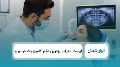 بهترین دکتر کامپوزیت در تبریز