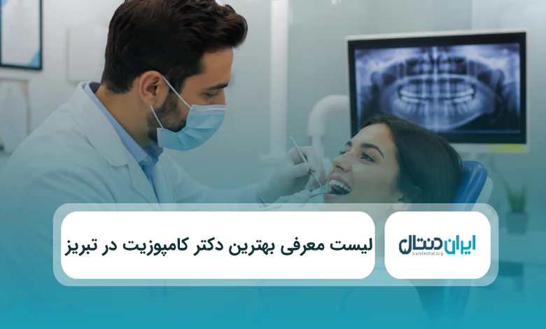 بهترین دکتر کامپوزیت در تبریز
