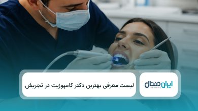 یهترین دکتر کامپوزیت در تجریش