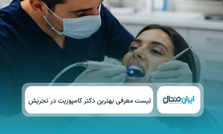یهترین دکتر کامپوزیت در تجریش