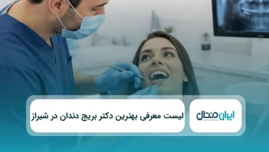 بهترین دکتر بریج دندان در شیراز