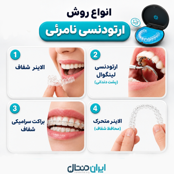 انواع روش های ارتودنسی نامرئی
