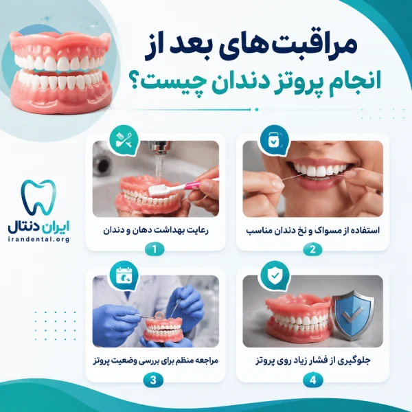 مراقبت های بعد از انجام پروتز دندان چیست؟