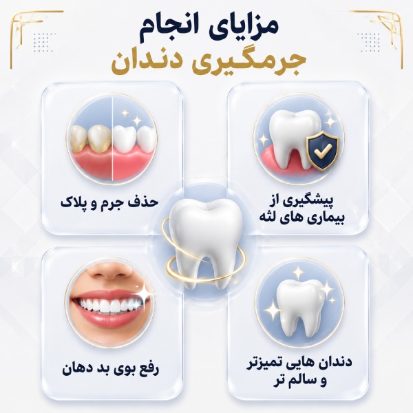 مزایای انجام جرمگیری دندان در اصفهان