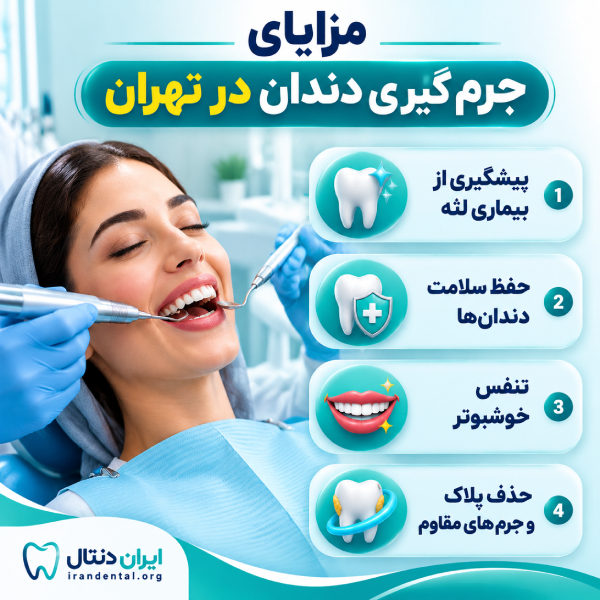 مزایای جرم گیری دندان در تهران