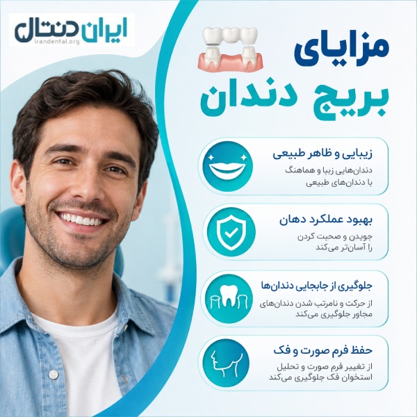 مزایای انجام بریج دندان در مشهد