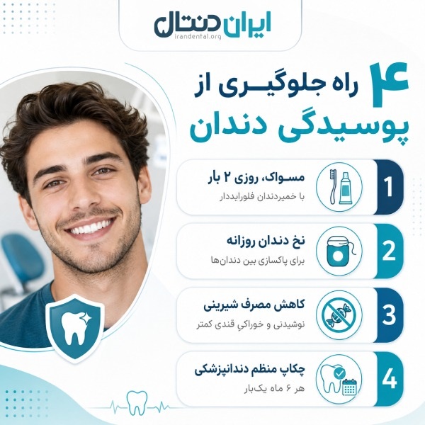 4 راه جلوگیری از پوسیدگی دندان