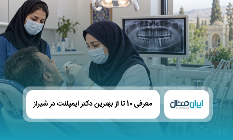 بهترین دکتر ایمپلنت در شیراز