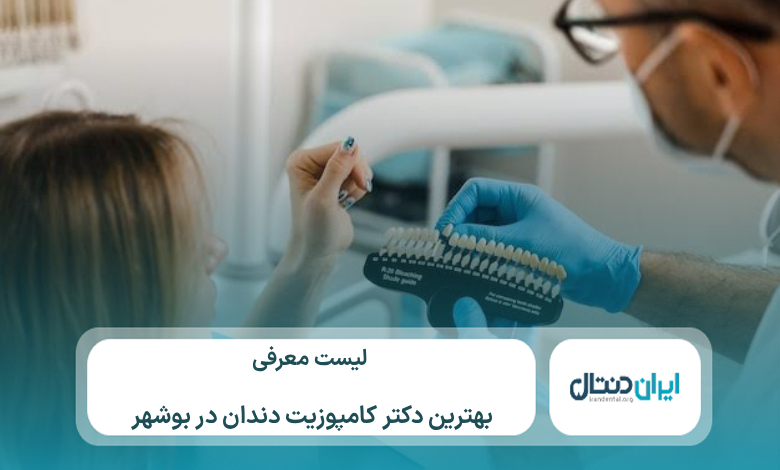 معرفی 10 تا از بهترین دکتر کامپوزیت در بوشهر⚡【سال1405】💙