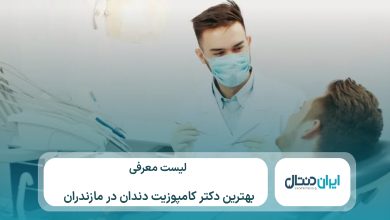 معرفی 10 تا از بهترین دکتر کامپوزیت در مازندران⚡【سال1405】💙