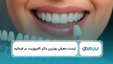 بهترین دکتر کامپوزیت در فرمانیه