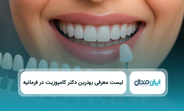 بهترین دکتر کامپوزیت در فرمانیه
