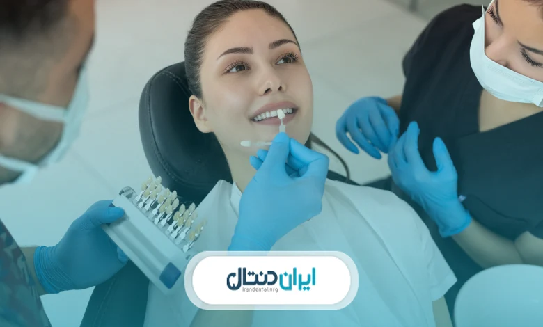 عمر کامپوزیت دندان چقدر است؟