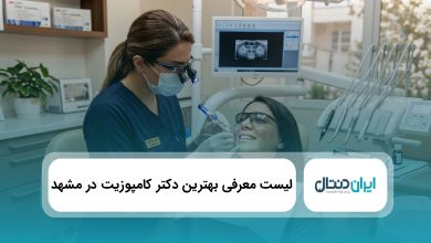 بهترین بهترین دکتر کامپوزیت در مشهد