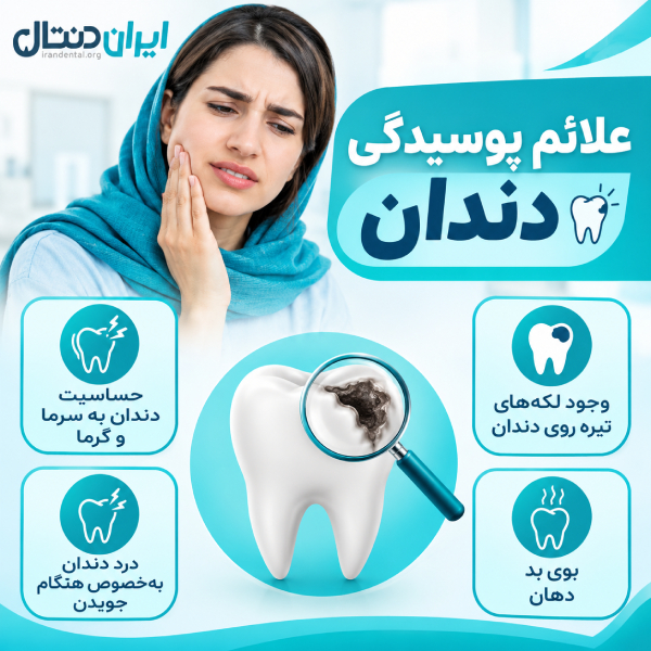 علائم پوسیدگی دندان چیست؟